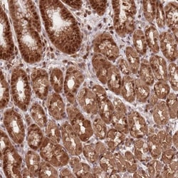 SALL1 Antibody, Novus Biologicals 0.1mL; Unlabeled:Antibodies, Polyclonal